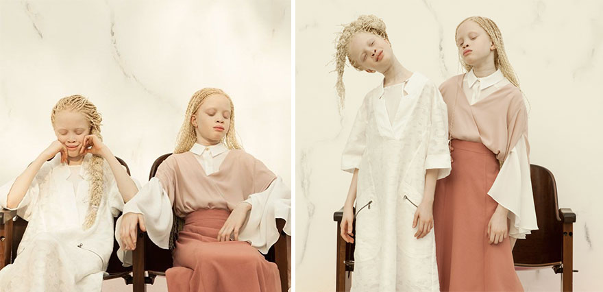 albino-twins-.jpg