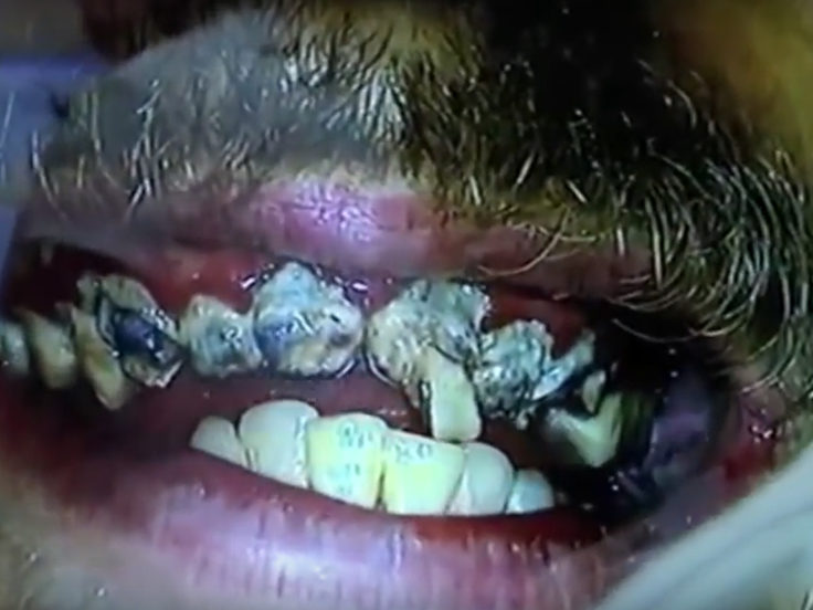 Jay-Teeth-1-736x552