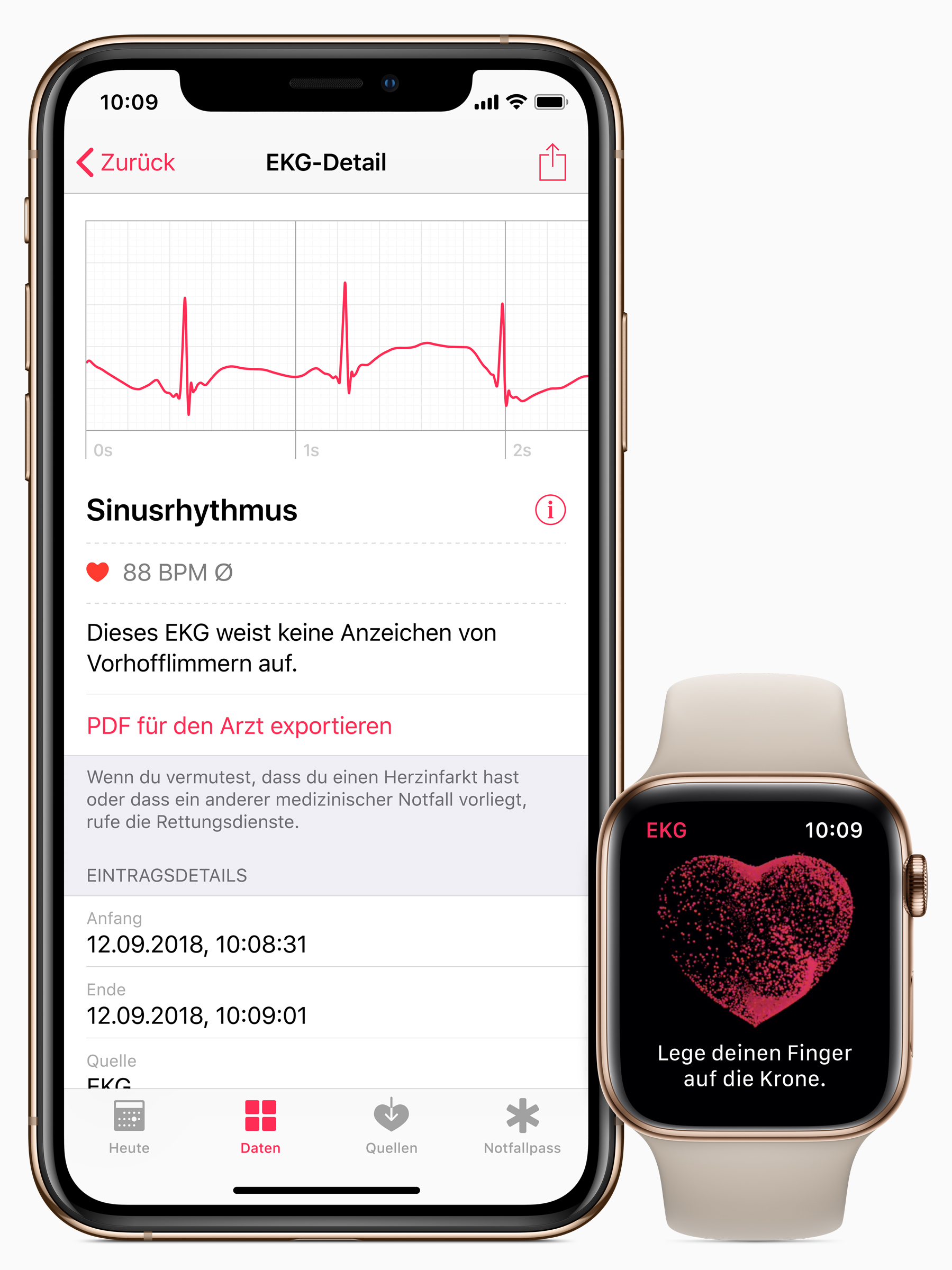 Apple-iPhone-watch-ecg-de-screen-03272019.jpg