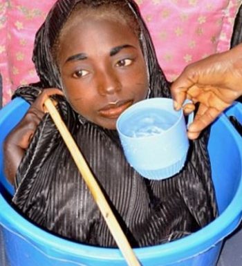 Δείτε το κορίτσι που ζει μέσα σε μπολ