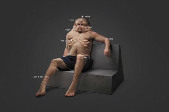 Εφιαλτικό: Πώς θα έμοιαζαν οι άνθρωποι εάν είχαν εξελιχθεί για να επιβιώνουν των τροχαίων