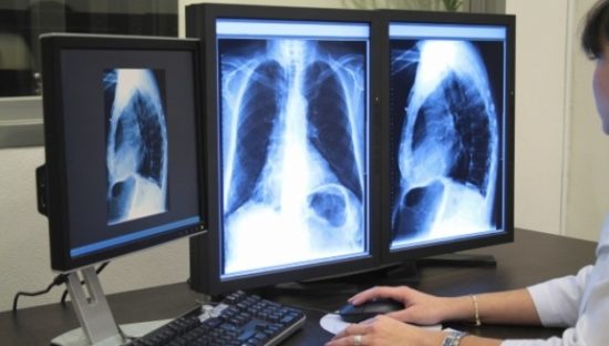 Αυτόματος «κόφτης» στις διαγνωστικές εξετάσεις από σήμερα