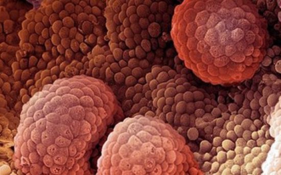 Εβδομάδα πρόληψης και ενημέρωσης κοινού για τον καρκίνο του προστάτη