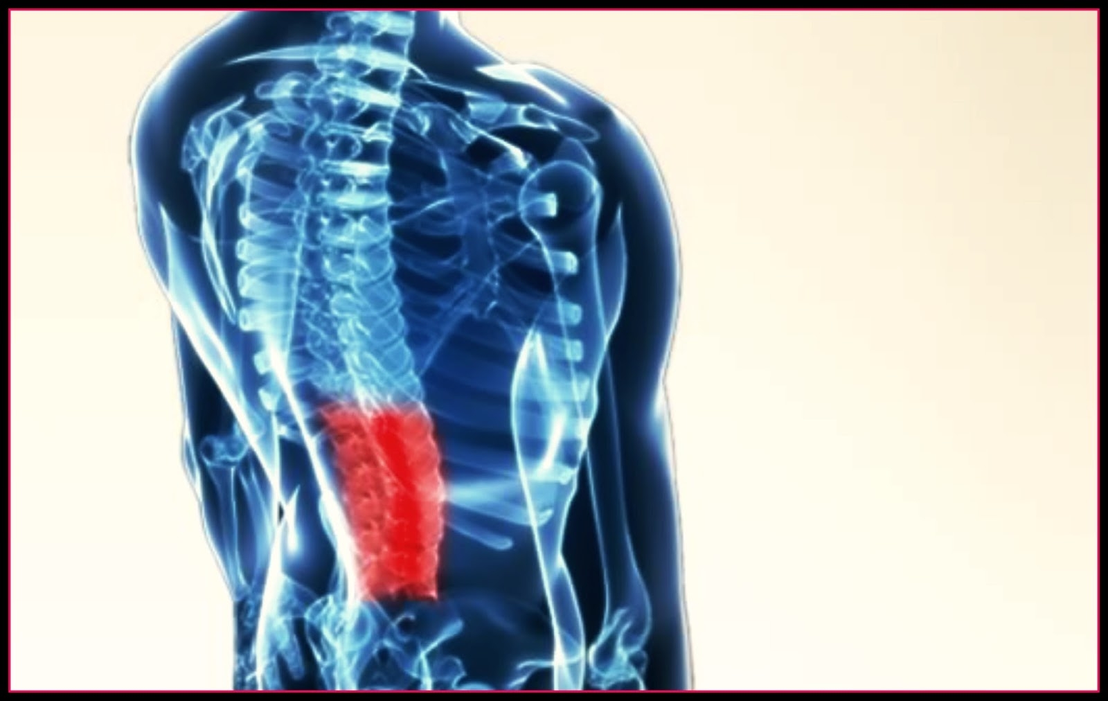 Σύνδρομο αποτυχημένης επέμβασης: Πώς αντιμετωπίζεται;