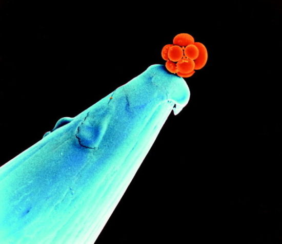 Guardian: Επιστήμονες δημιούργησαν συνθετικά ανθρώπινα έμβρυα με χρήση βλαστοκυττάρων
