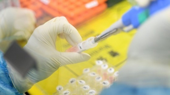 Kορωνοϊός: Επιστήμονες δημιούργησαν PCR που ανιχνεύει τον ιό μέσα σε λίγα λεπτά