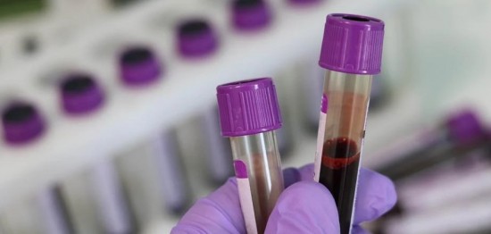 ΗΠΑ: Το CDC ερευνά 109 σοβαρές περιπτώσεις ηπατίτιδας σε παιδιά – 5 θάνατοι