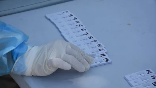 Ανεμβολίαστοι εργαζόμενοι: Τι ισχύει για τα rapid test