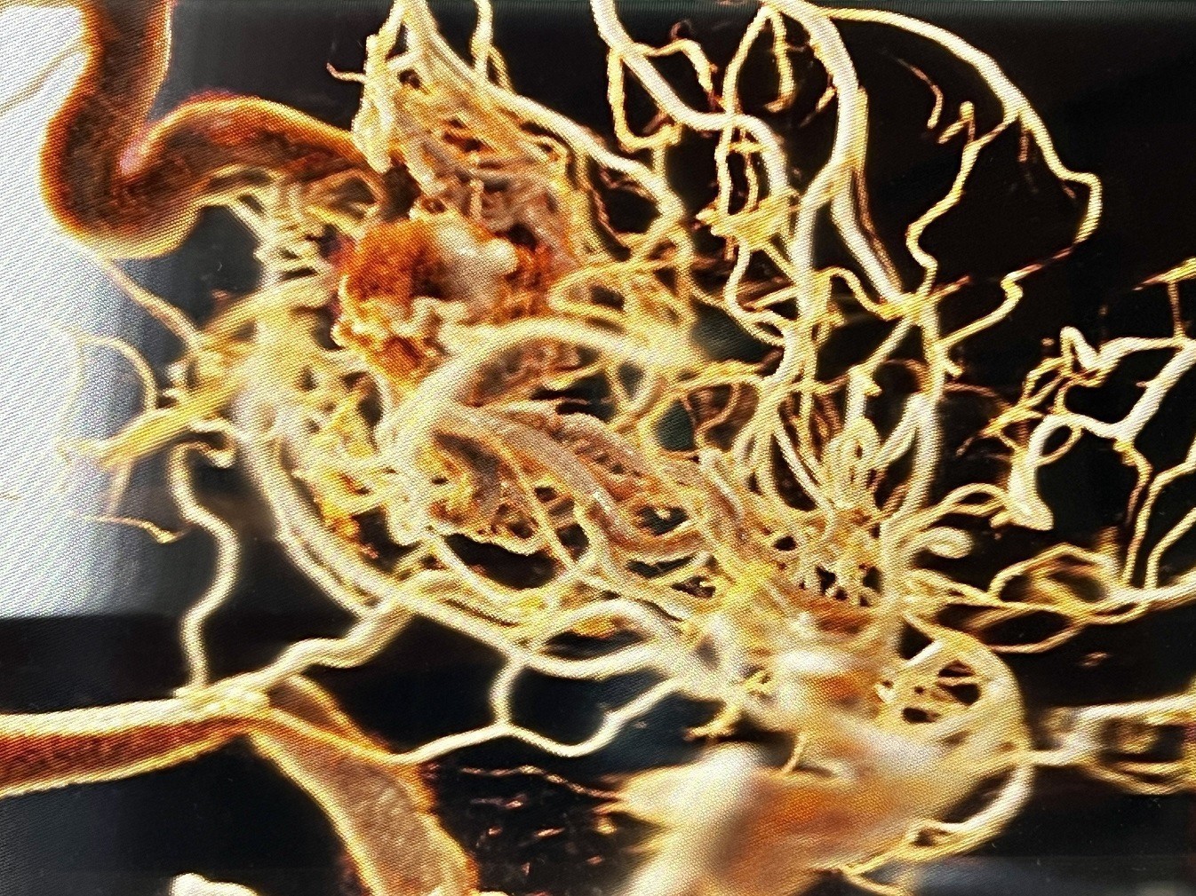 Τεχνητή Νοημοσύνη στην Υγεία: H επανάσταση είναι εδώ αλλά ίσως αργήσει να εφαρμοστεί (pics)