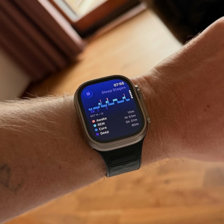 Εθισμός στα smartwatch: Κοιμάστε ήσυχοι ή αγχώνεστε για τα data του ύπνου