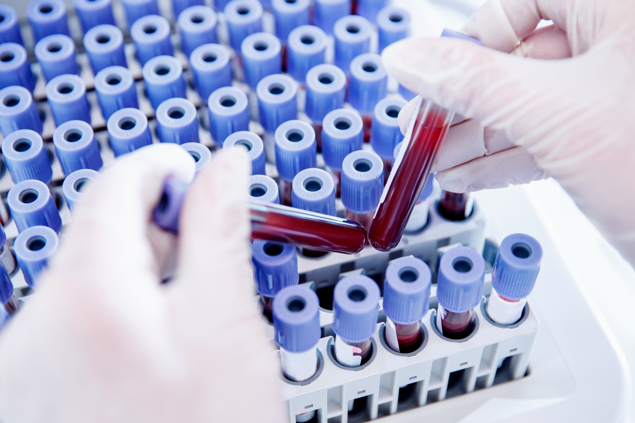 Τι είναι το «χρυσό αίμα» που κυλά στις φλέβες μόνο 50 ανθρώπων στον κόσμο