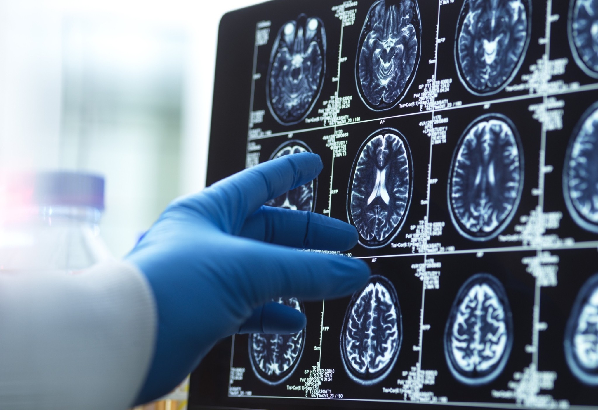 Αυτές είναι οι ηλικίες στη ζωή μας που ο εγκέφαλός μας αλλάζει